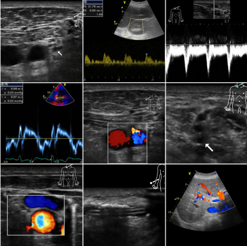 Logo Ultraschall-Kurs